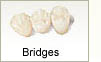 Bridges