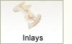 Inlays